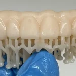 Impresora 3D dental: por qué una impresión recién salida no está lista