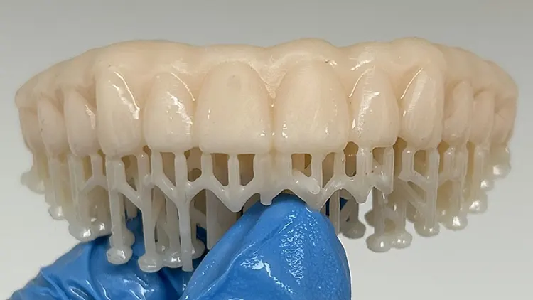 Arcada dental superior impresora 3D en resina con soportes, usada en odontología digital.
